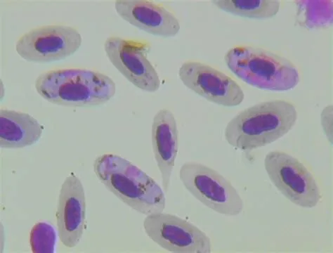  Hematocystis! This Ancient Blood-Dwelling Parasite Thrives Within Its Bird Host's Red Blood Cells