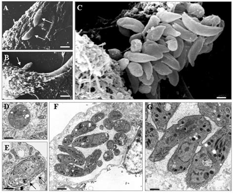  Neospora - Tenacious Parasite Lurking Within, Causing Havoc in Mammalian Hosts!